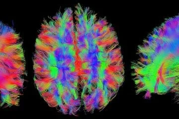 Frontal Parts Of The Brain Click Back In During Lucid Dreams Despite Them  Normally Being Off During REM Sleep » LUCID DREAM RESEARCH