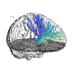 Changing our Minds: A Journey to the Centre of the Brain